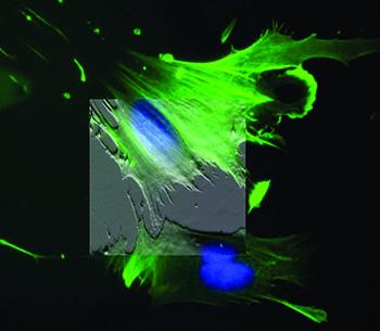 細胞の原子間力顕微鏡 (AFM) 像。同じ細胞の蛍光顕微鏡像に重ね合わせている。